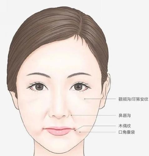 米扬丽格马平山医生采用PLLA艾维岚在口周年轻化方面的成果(图6)