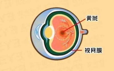 爱尔眼科：激光“打”在眼内还能治眼病？(图3)