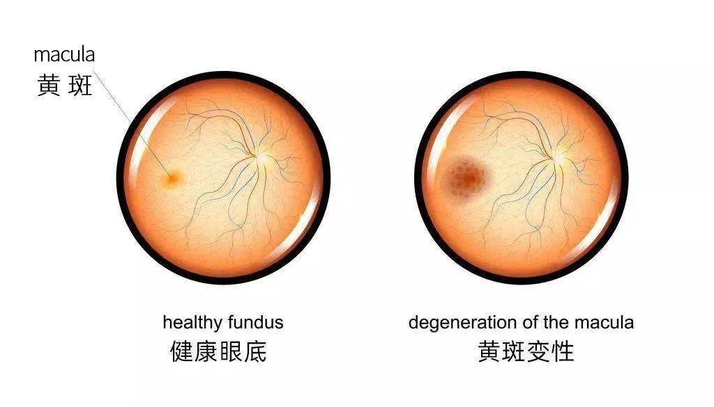 叶黄素对眼睛真的有效吗？一文读懂它的功效与作用(图3)